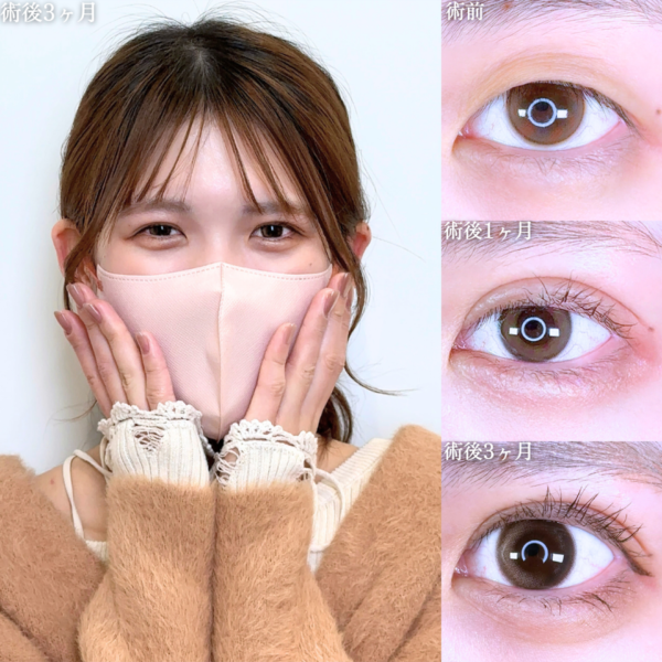 No.10633の症例写真