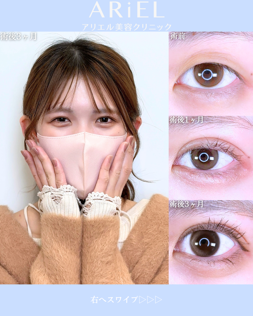 No.10633の症例写真