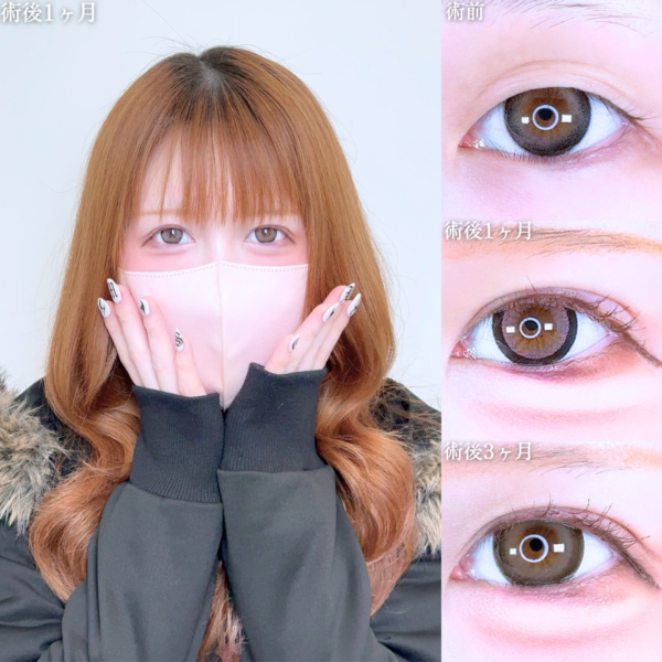 No.10517の症例写真