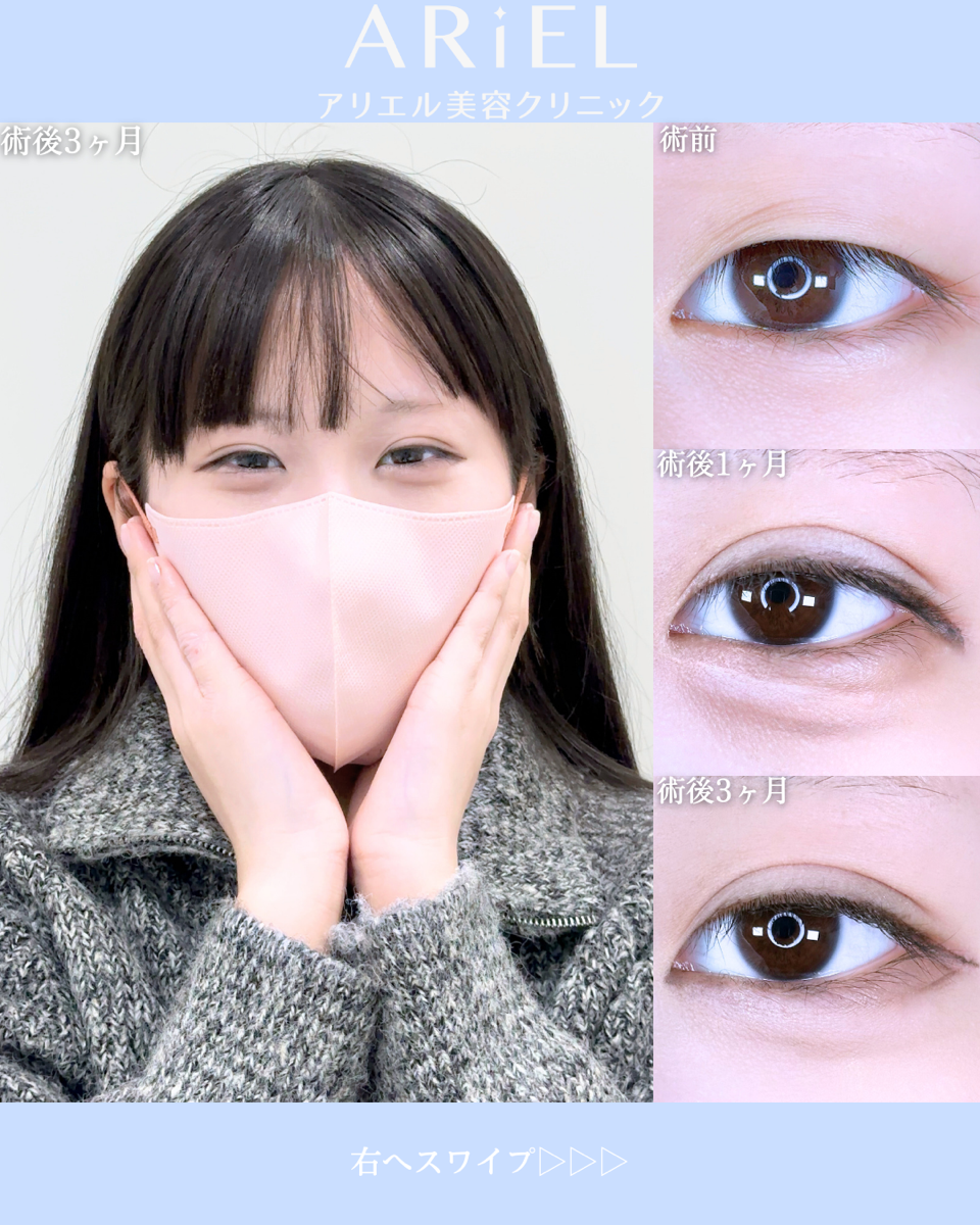 No.10645の症例写真