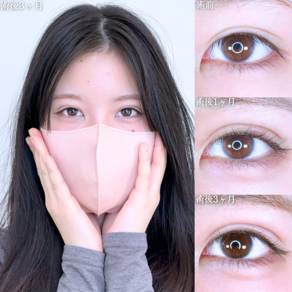 No.10686の症例写真