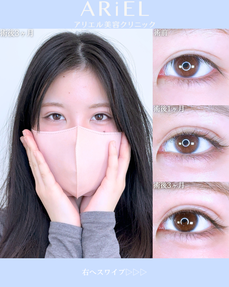 No.10686の症例写真