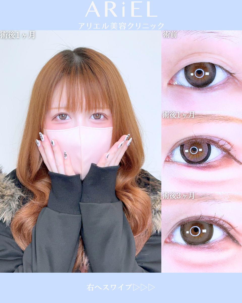 No.10517の症例写真