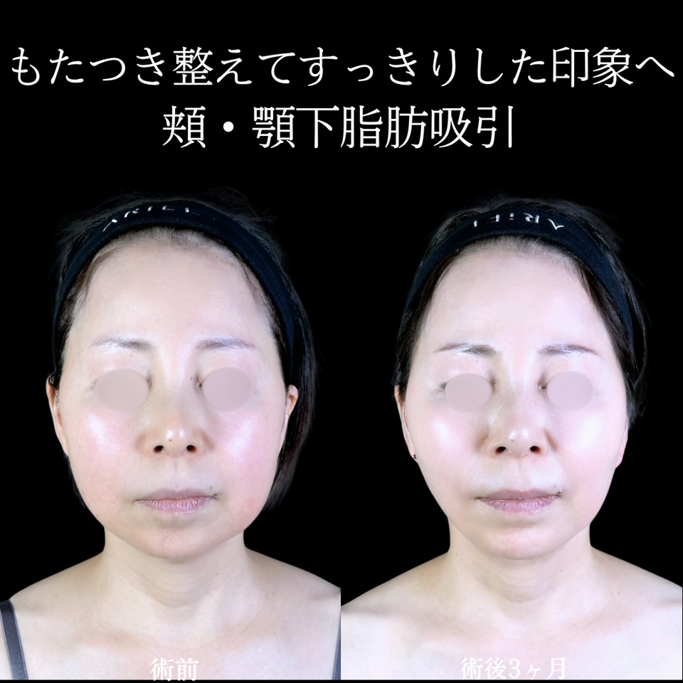 No.11086の症例写真