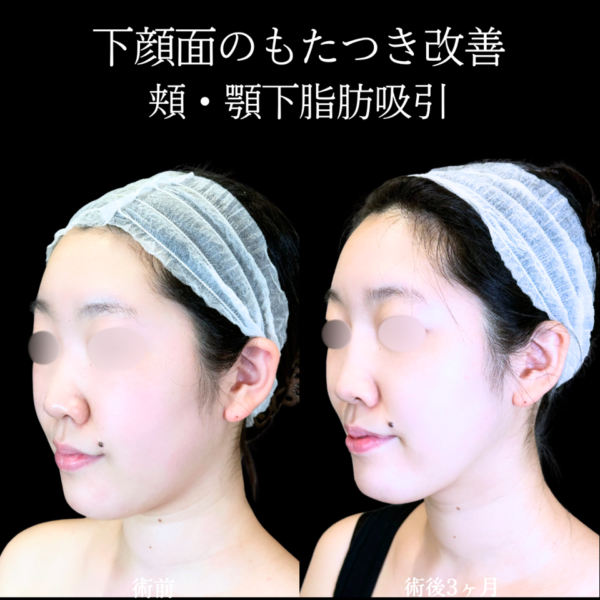 No.11253の症例写真