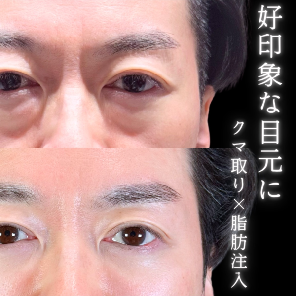 No.11031の症例写真