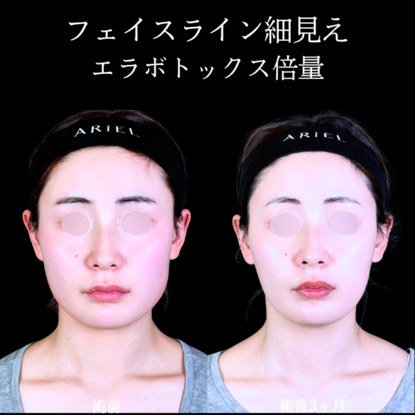 No.11068の症例写真