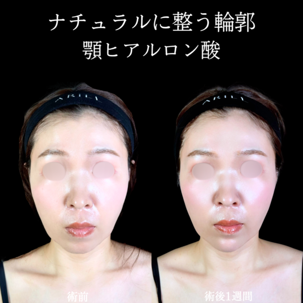 No.11235の症例写真