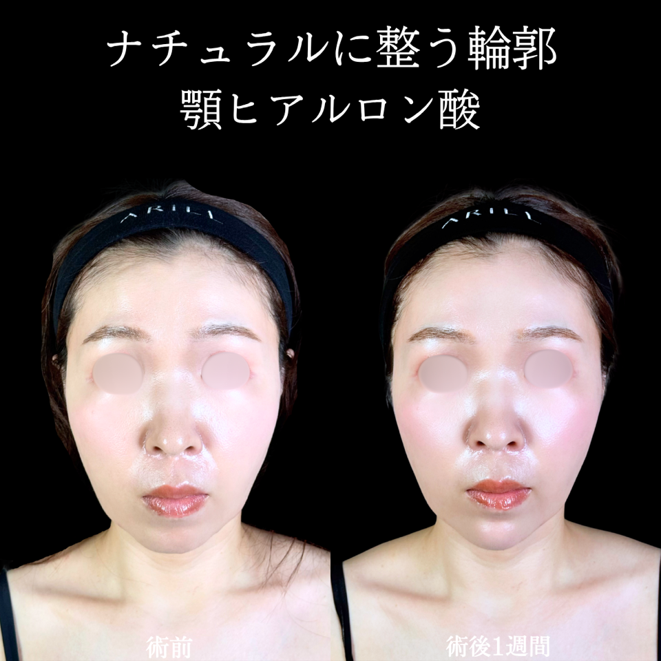 No.11235の症例写真