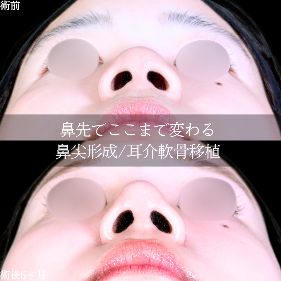 No.11276の症例写真