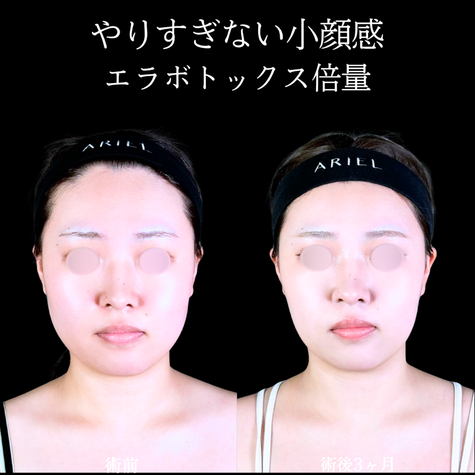 No.11199の症例写真