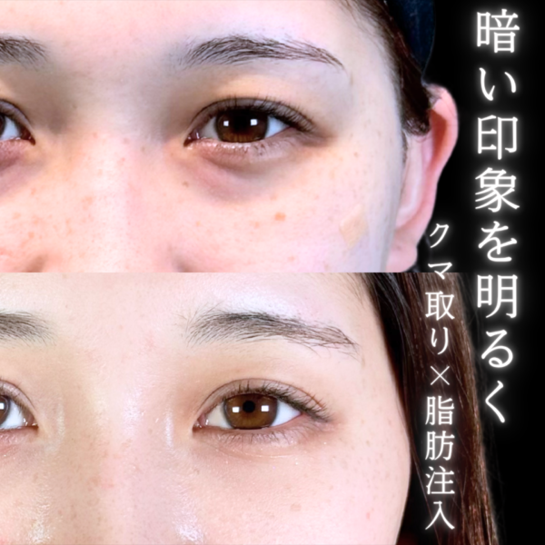 No.11107の症例写真