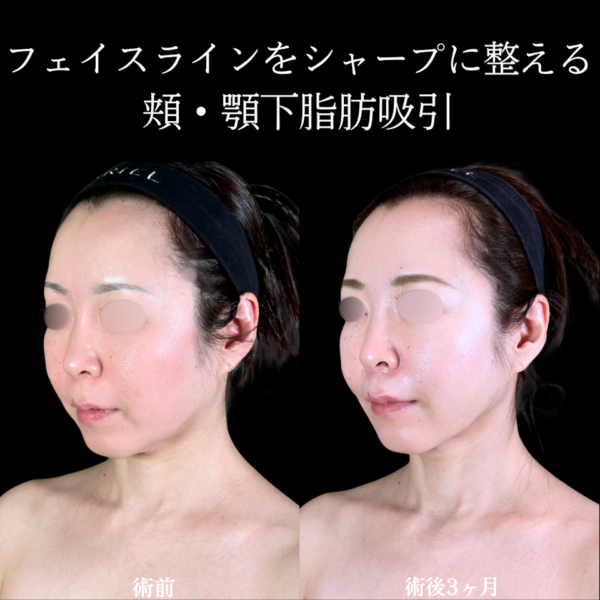 No.11217の症例写真