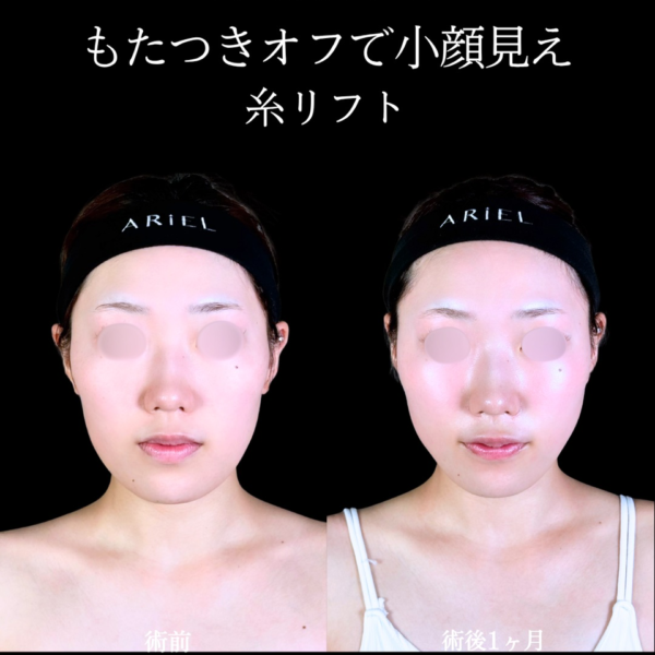 No.11050の症例写真