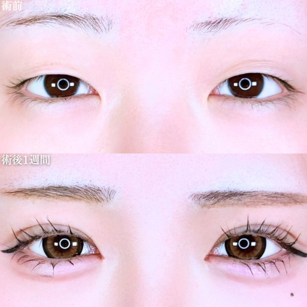 No.11079の症例写真