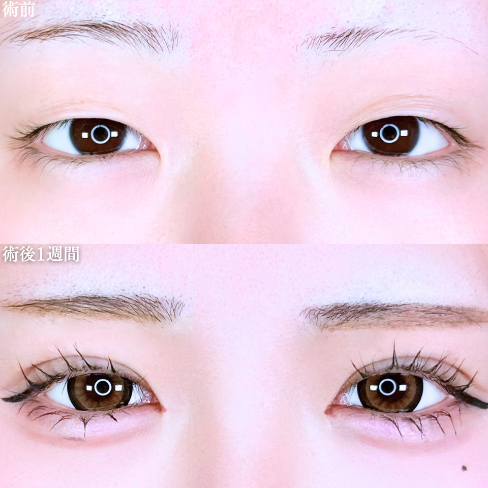 No.11079の症例写真