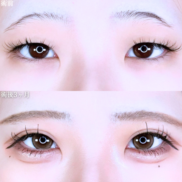 No.11247の症例写真