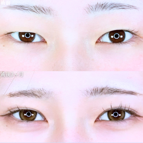 No.11264の症例写真