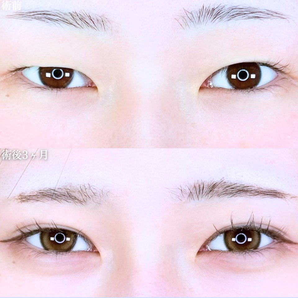 No.11264の症例写真