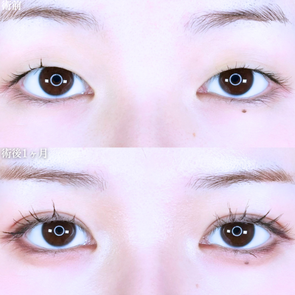 No.11062の症例写真