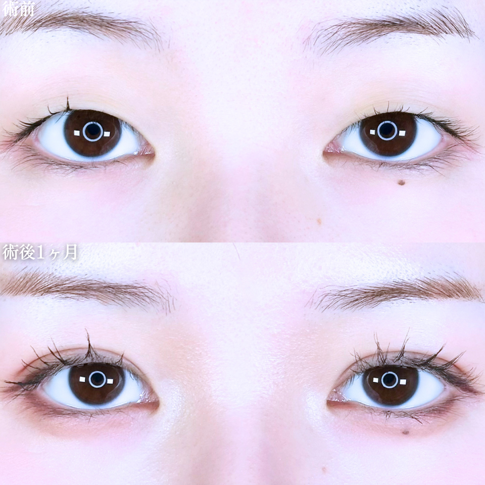 No.11062の症例写真