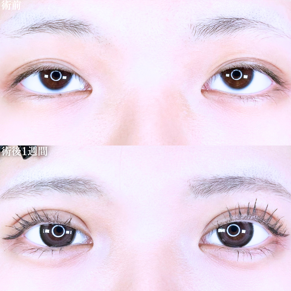 No.11119の症例写真