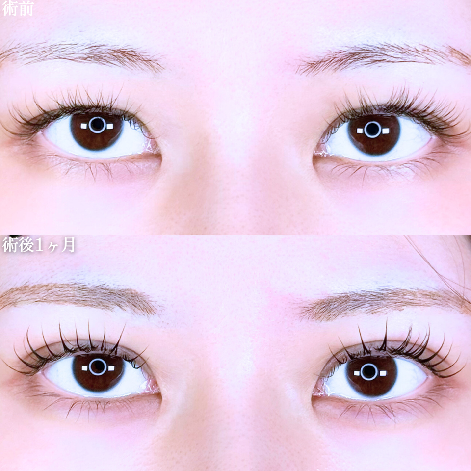 No.11025の症例写真