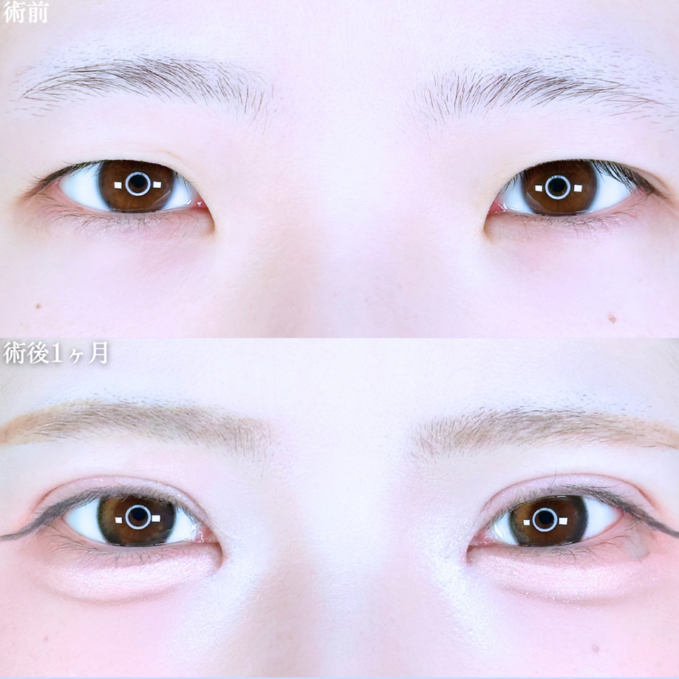 No.11230の症例写真