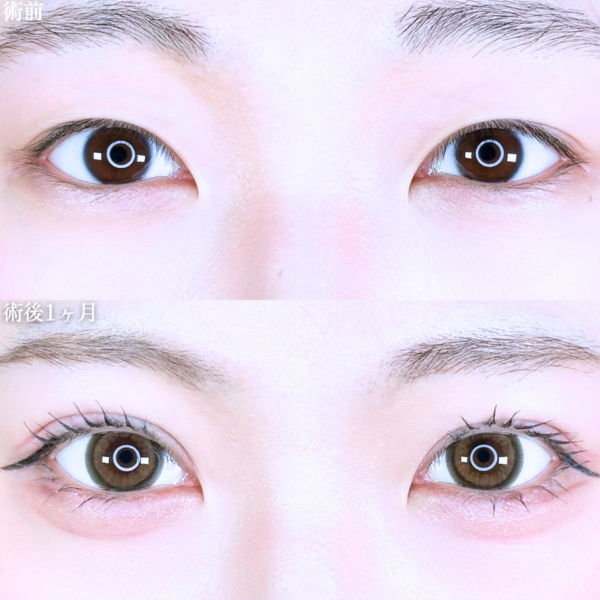 No.11211の症例写真