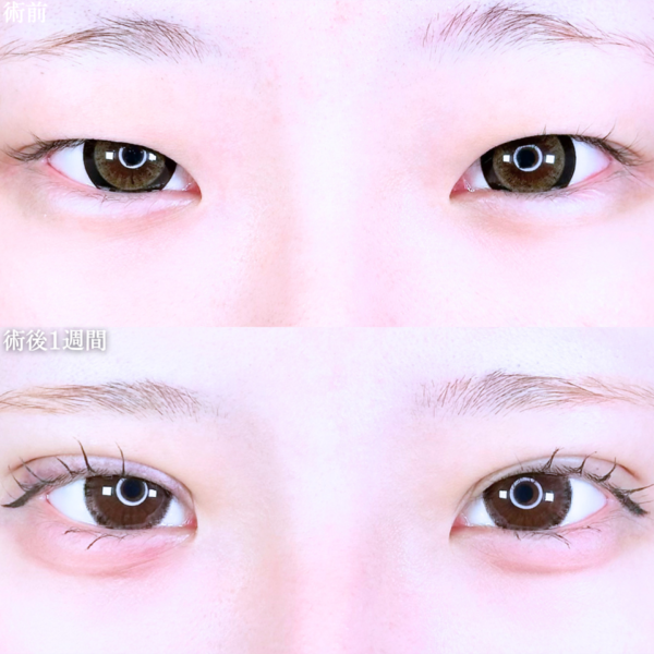 No.11043の症例写真