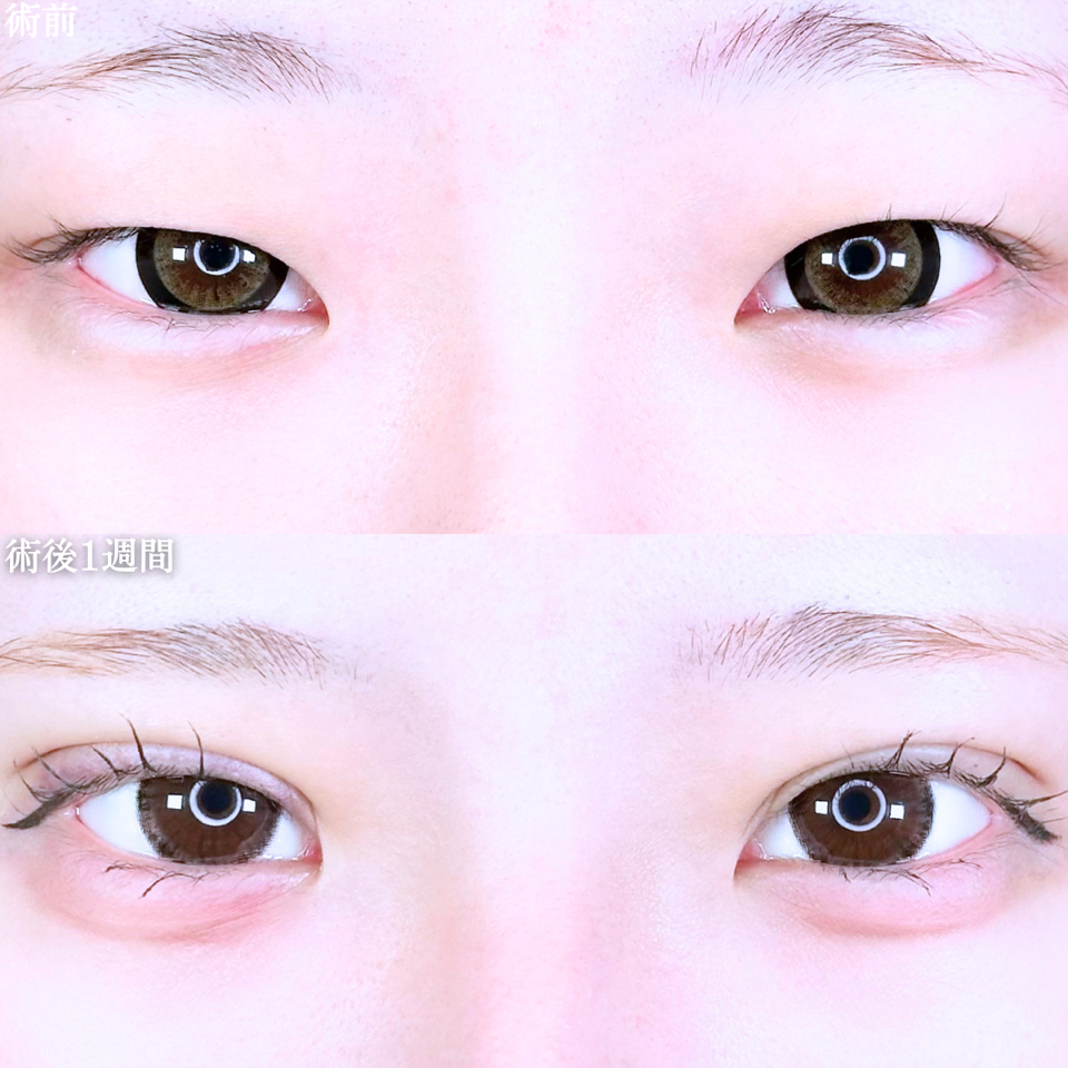 No.11043の症例写真