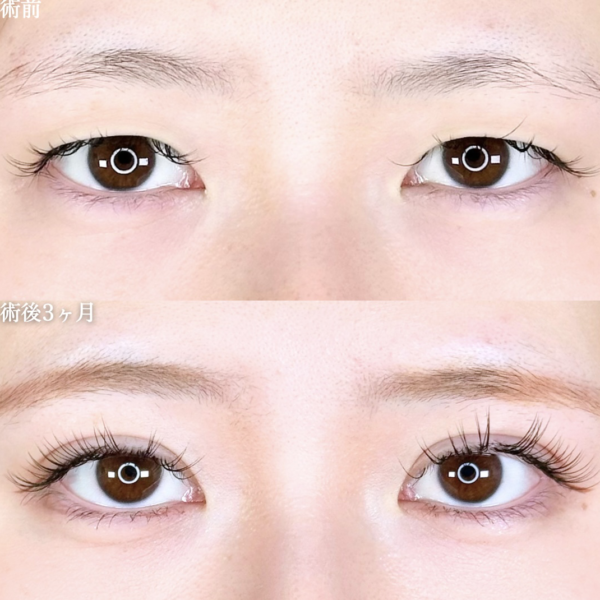 No.11098の症例写真