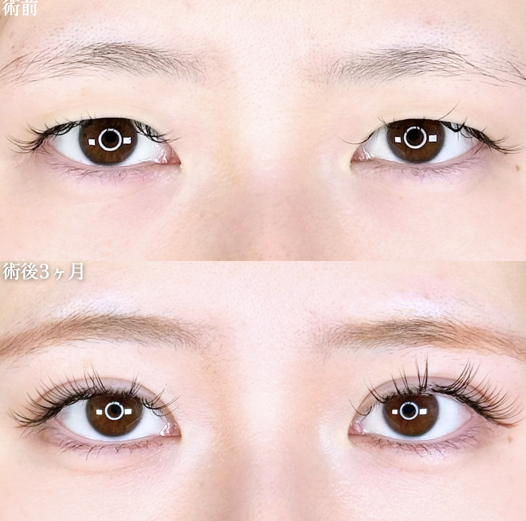 No.11098の症例写真