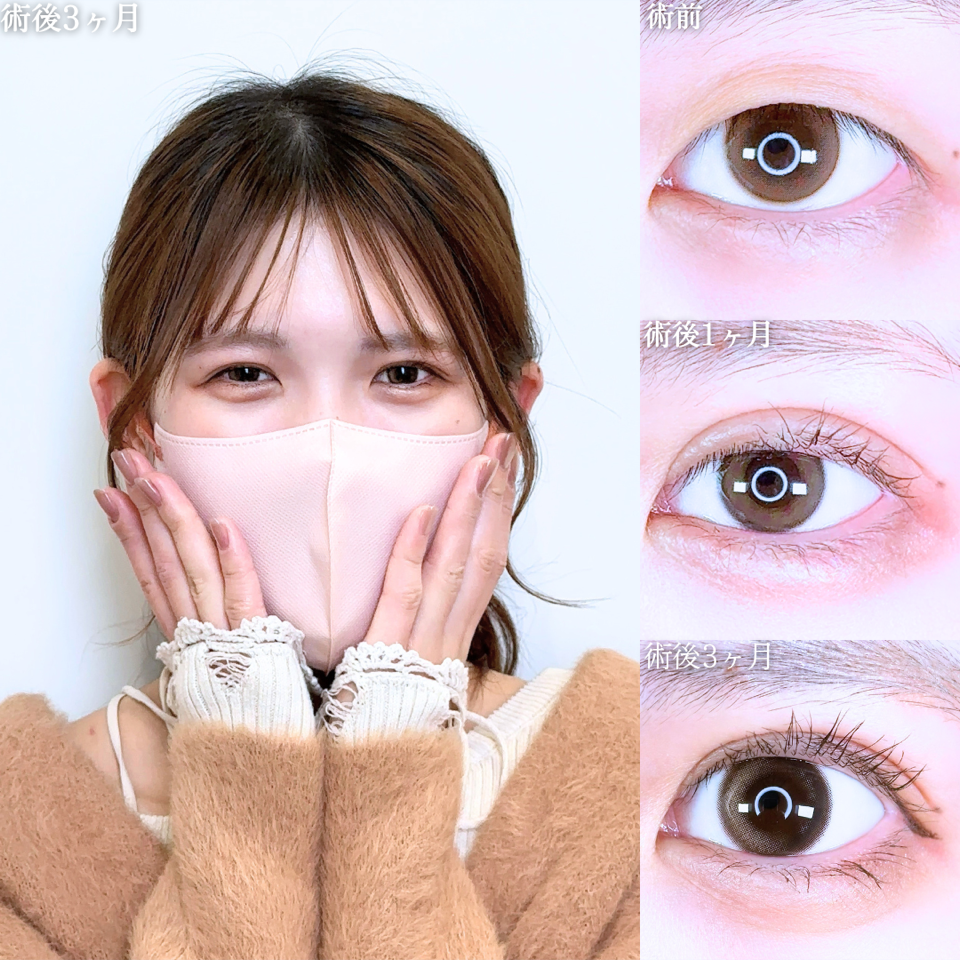 No.11224の症例写真