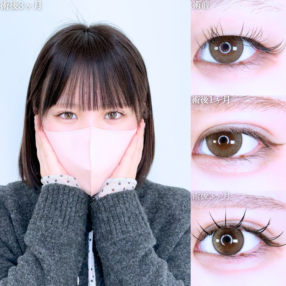 No.11241の症例写真