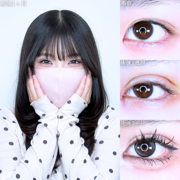 No.11259の症例写真