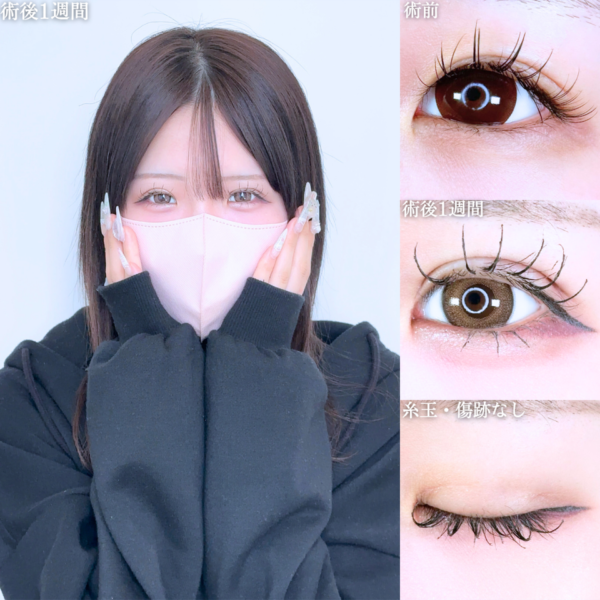 No.11270の症例写真