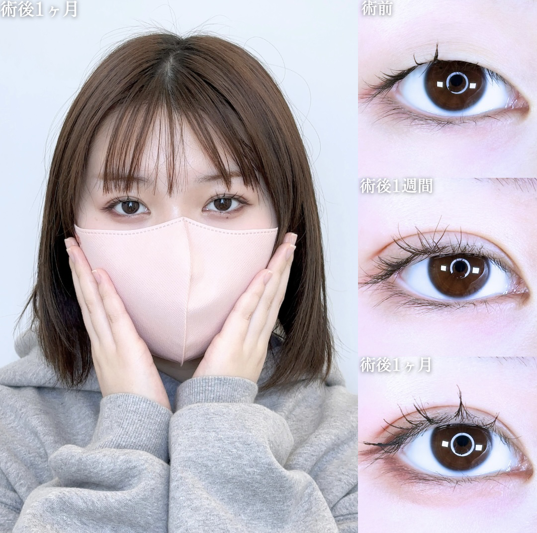 No.11037の症例写真