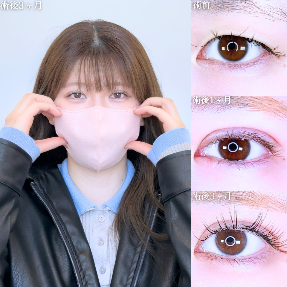 No.11056の症例写真