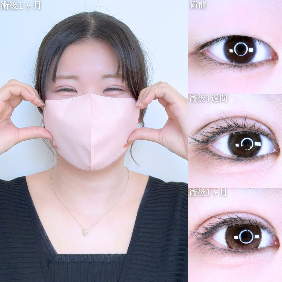 No.11092の症例写真