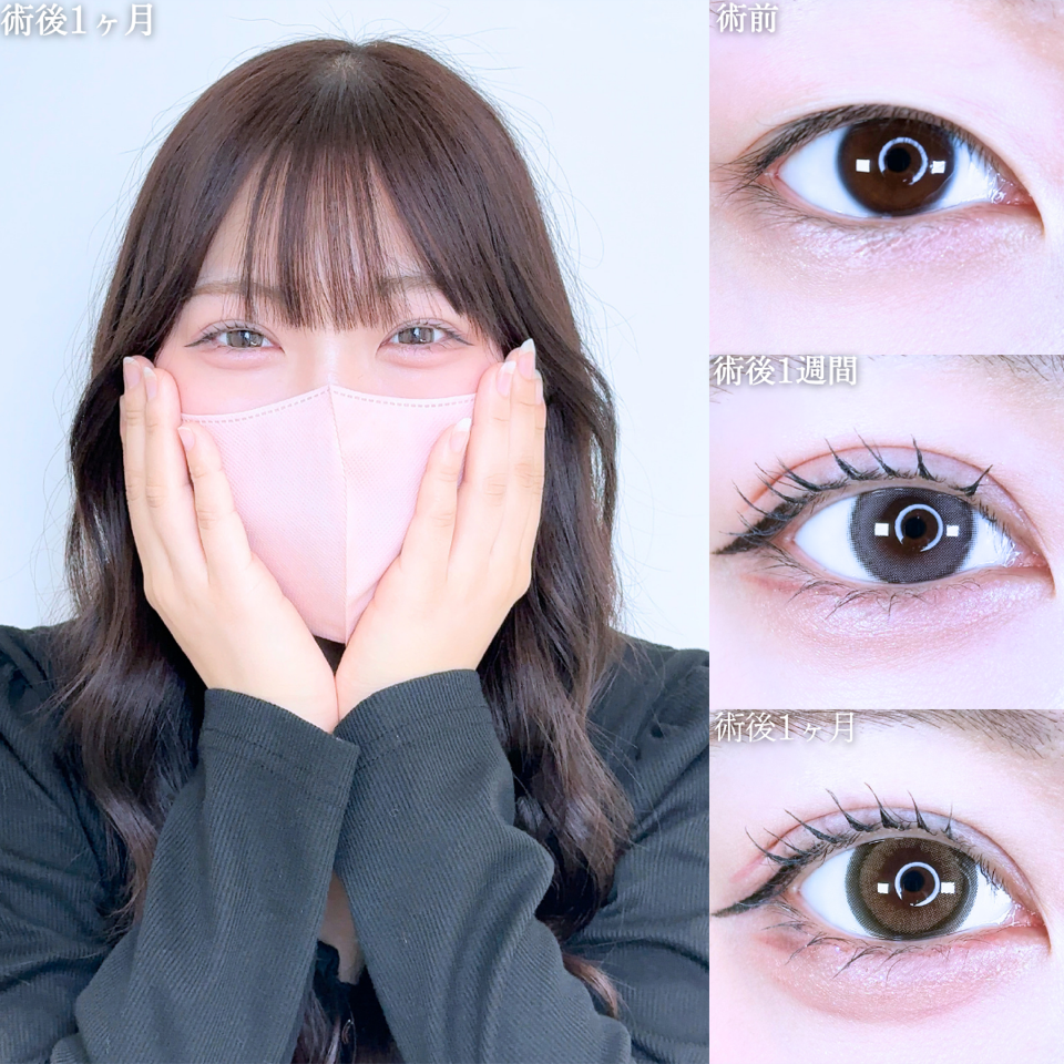 No.11113の症例写真