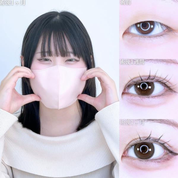 No.11074の症例写真