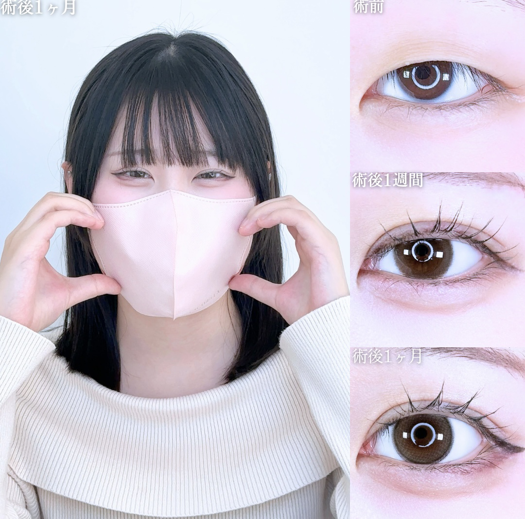 No.11074の症例写真