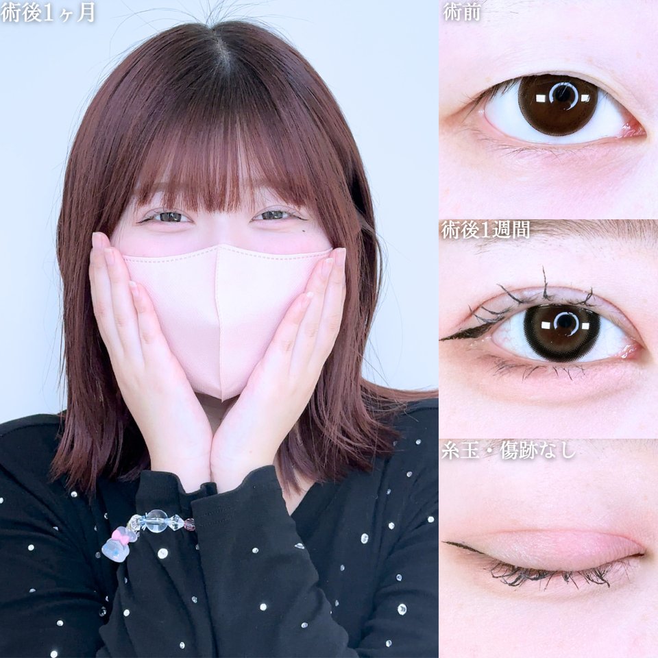 No.11367の症例写真