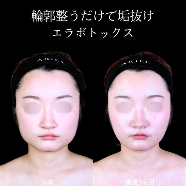 No.11379の症例写真