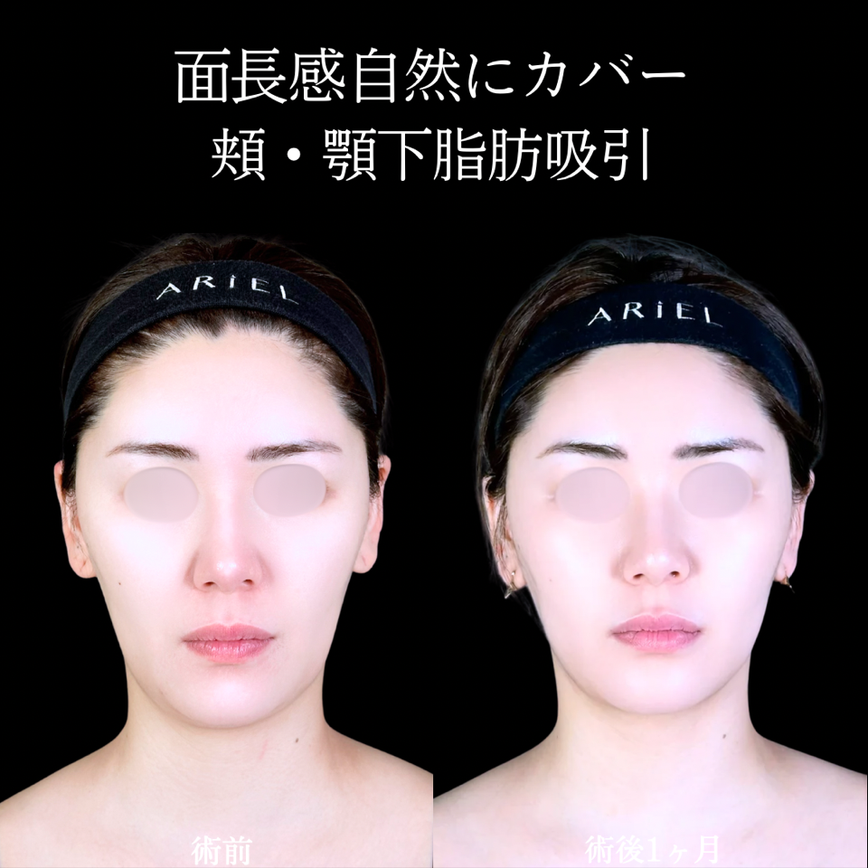 No.11452の症例写真