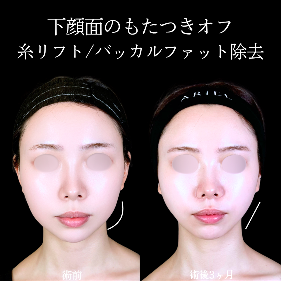 No.11476の症例写真