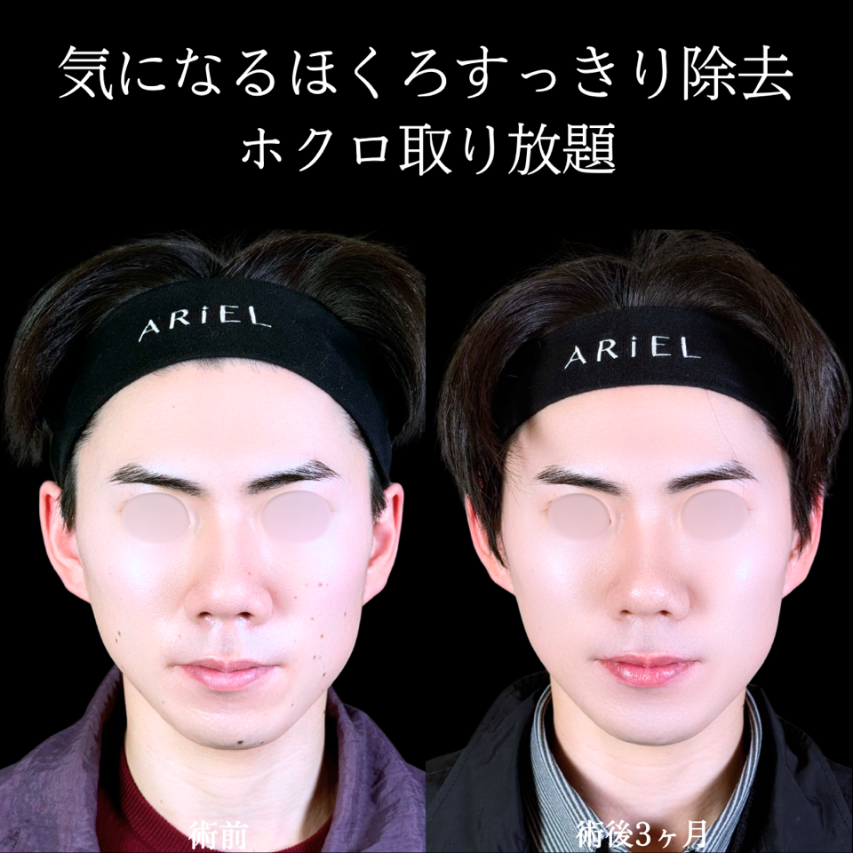 No.11580の症例写真