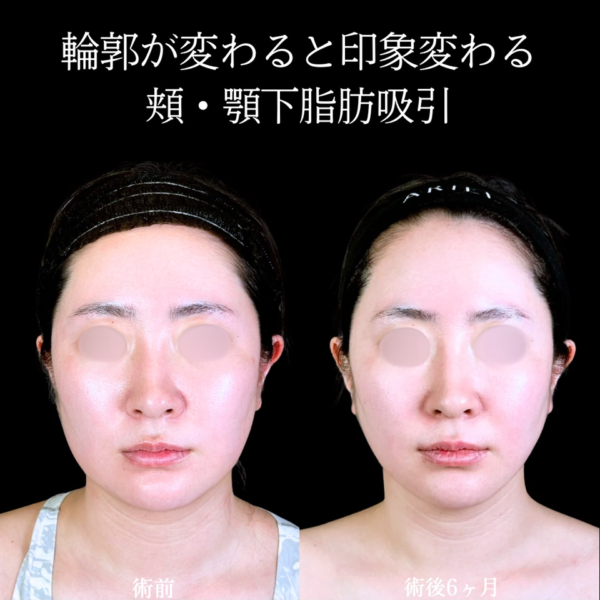 No.11416の症例写真