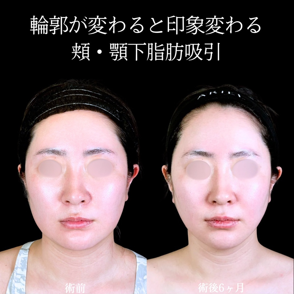 No.11416の症例写真